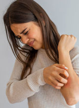 Hvad er nældefeber – og hvordan kan jeg behandle det?